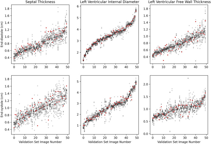 Echocardiography research